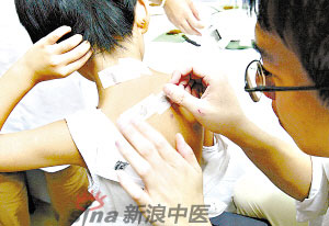 灸法的種類  你知道多少？